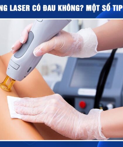 Triệt lông bằng công nghệ Diode laser ruby AI có đau không?