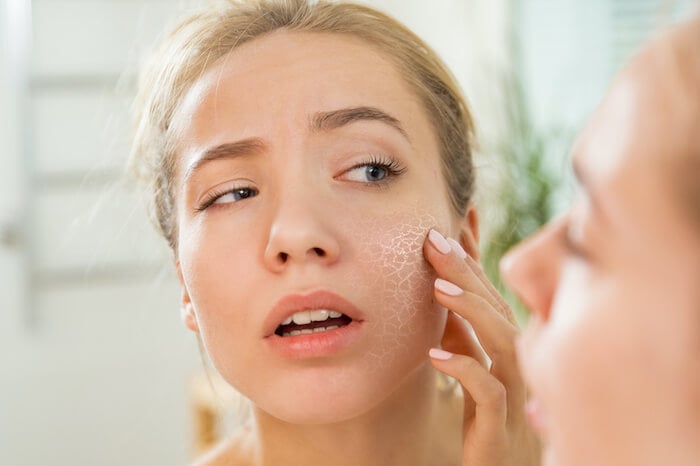 Top 5 sai lầm chăm sóc da kho vào mùa hè